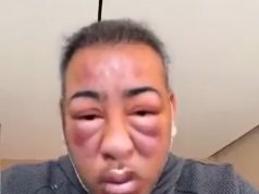 بين الفلتر والحقيقة: الإعتداءات على السُّياح الخليجيين في تركيا وسُخرية الواقع