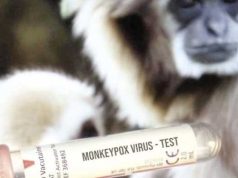 الكاميرون ترفع حالة التأهب القصوى بسبب تفشي جدري القردة