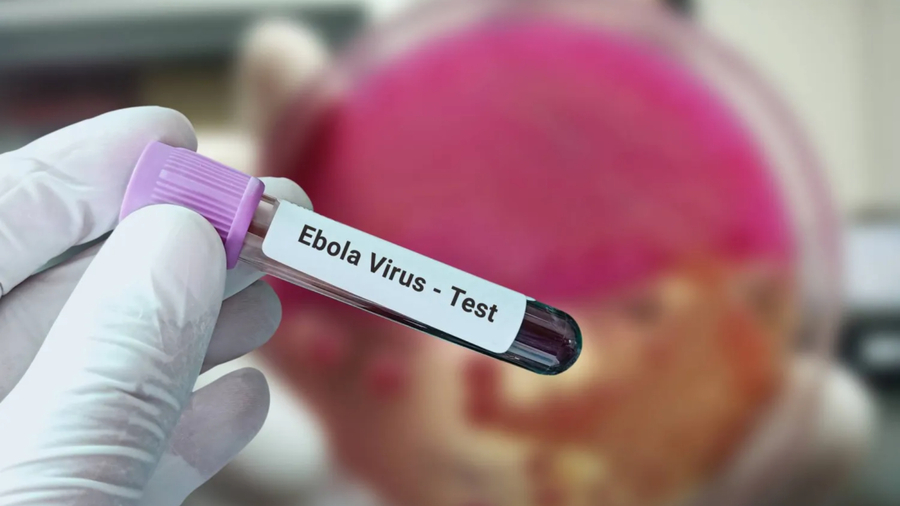 الولايات المتحدة تخصص 38 مليون دولار إضافية لمكافحة «إيبولا» وسط مخاوف من اتساع رقعة التفشي