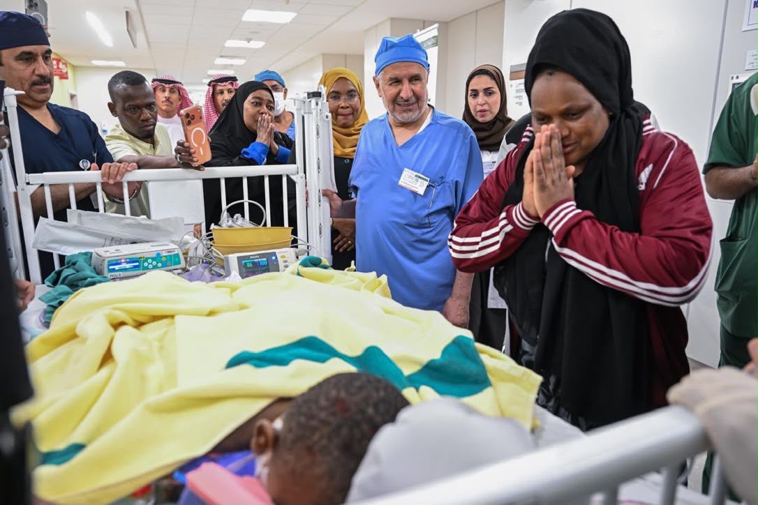 نجاح عملية فصل التوأم الملتصق التنزاني (لايتيينس ولوفنس) بعد (14) ساعة ونصف